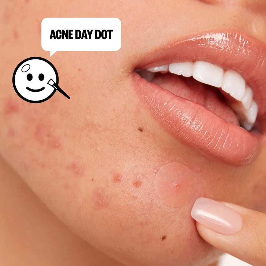Acne Day & Night Duo