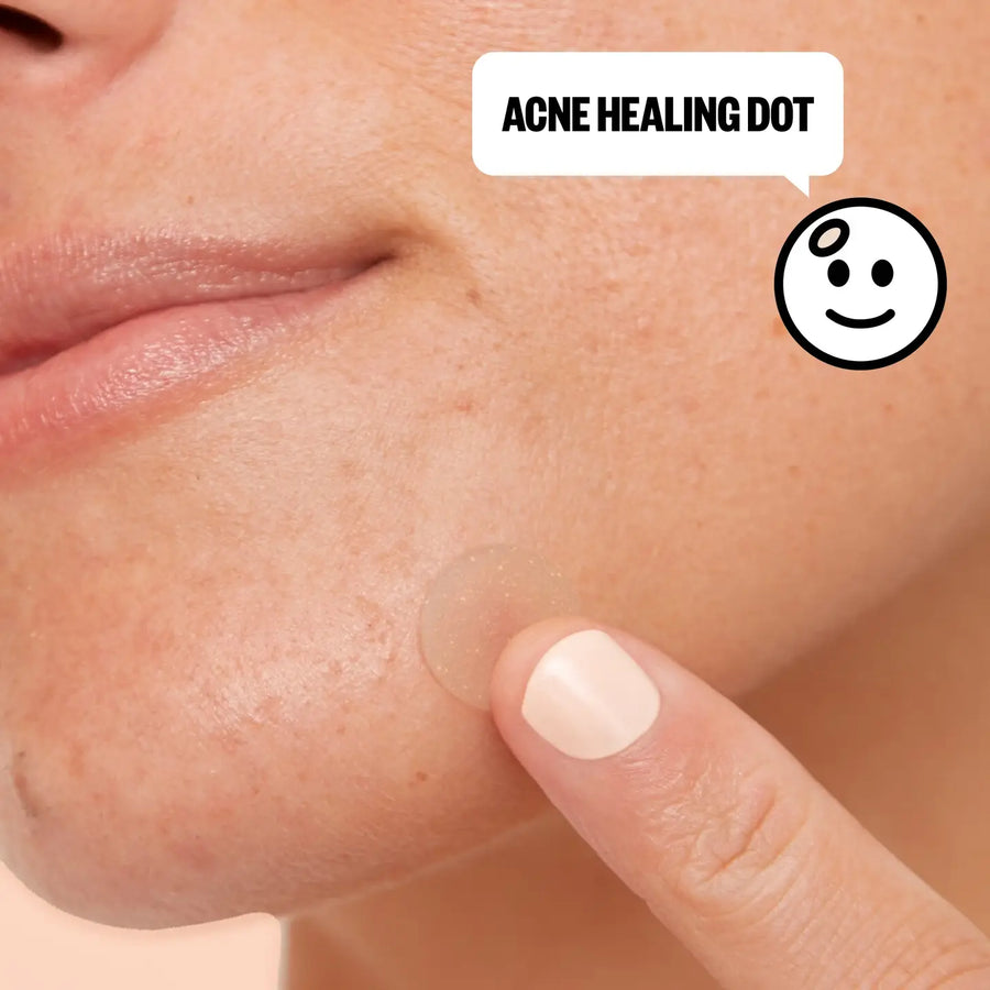 Acne Day & Night Duo